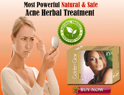 Herbal Acne Pills, Ayurvedic Blood Purifier For Pimple Natural Treatment