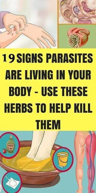 Those are the Signs Parasites are Residing In Your Body!