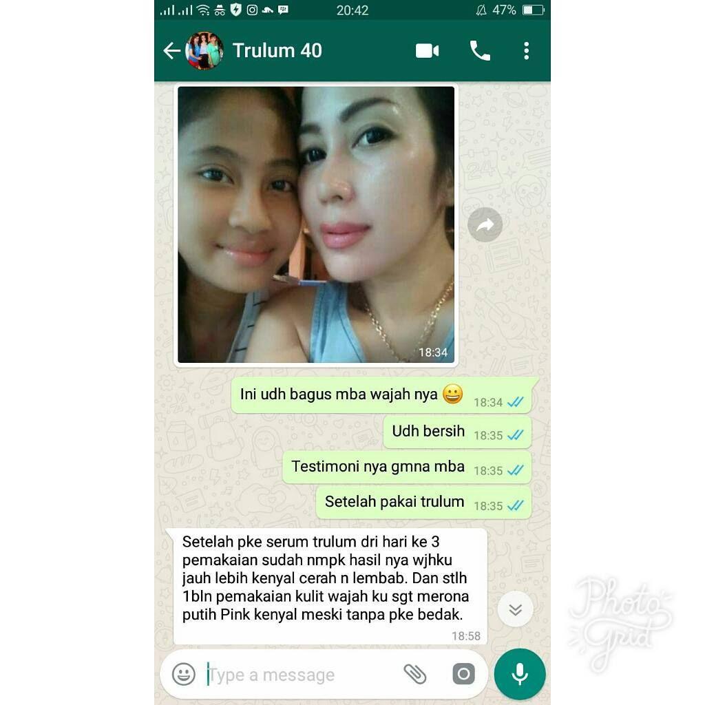 Klinik Kecantikan Trulum Skincare Di Daerah Tanimbar Utara, Maluku Tenggara Barat WA: 08112338376