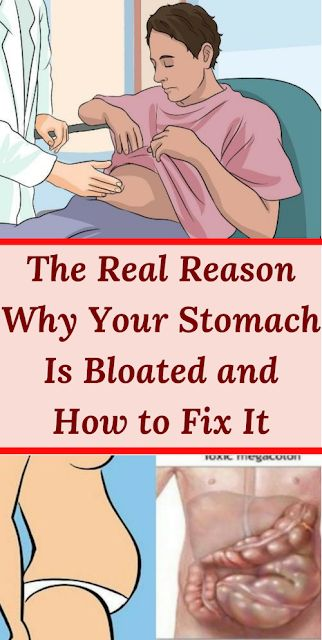 The Real Reason Why Your Stomach Is Bloated And How To Fix It