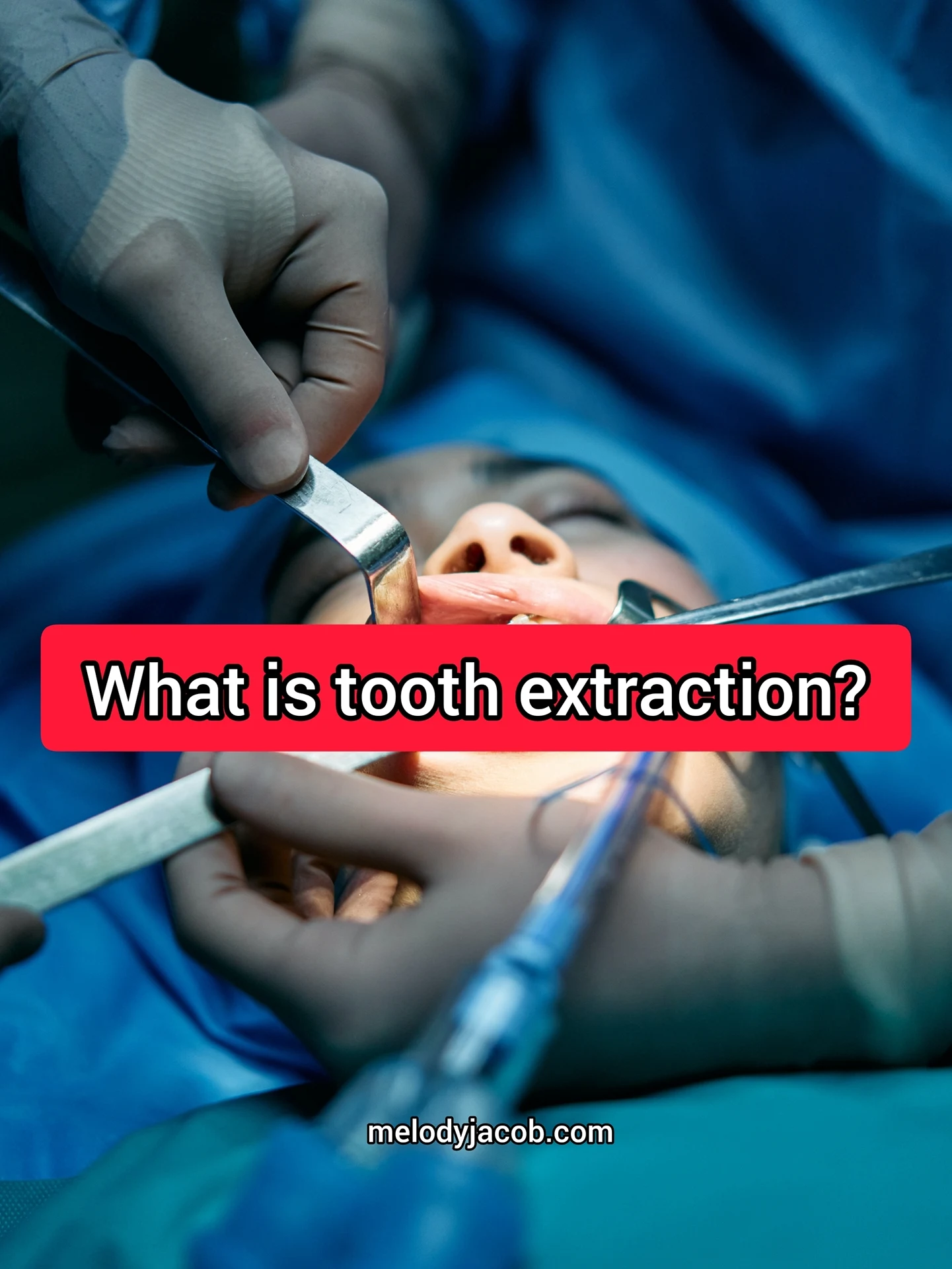 A tooth extraction process