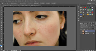 Profesional Skin Retouching