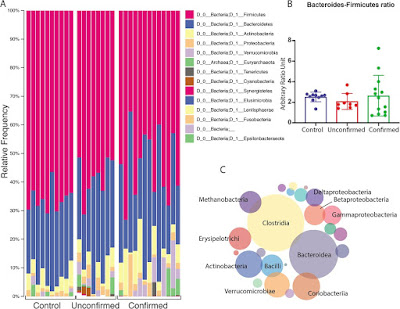 Gut bacteria and dry eyes in Sjogren's syndrome study