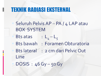 Teknik Radiasi Eksternal