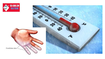 What is Hypothermia?