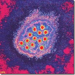 hepatitis a