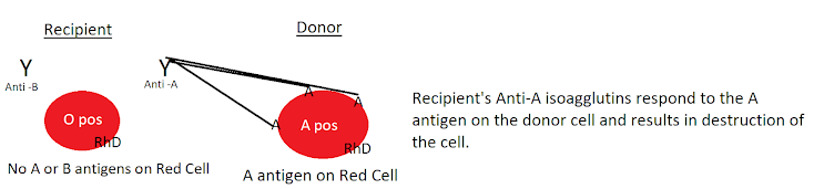 Acute Hemolytic Transfusion Reaction