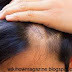 How to stop hair loss with natural ingredients|10 Proven Home Remedies for Hair Loss