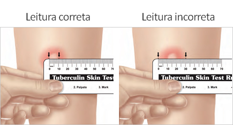 Leitura PPD