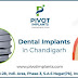 Dental Implant in Chandigarh | Best Dental Implants