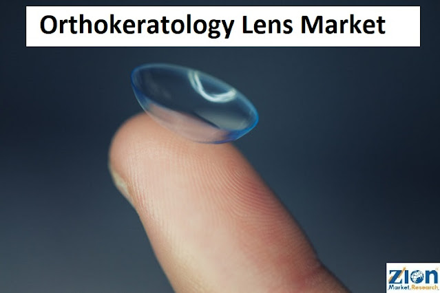 Orthokeratology Lens Market Size