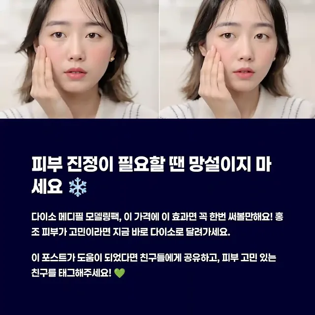 피부 진정이 필요할 땐 망설이지 마세요