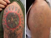 http://obattattoo.blogspot.com/2015/06/hasil-dari-obat-penghilang-tatto.html