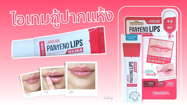 review mediheal labocare panteno lips healbalm chortuang รีวิวลิปบาล์ม เมดิฮีล แก้ปากแห้ง ปากเป็นร่อง ร่องปาก