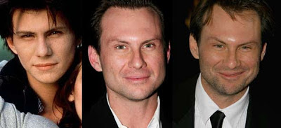 Christian Slater Plastic Surgery Before and After Botox ...