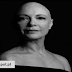 Carla Andrino partilha fotos inspiradoras para todas as mulheres que tem cancro 
