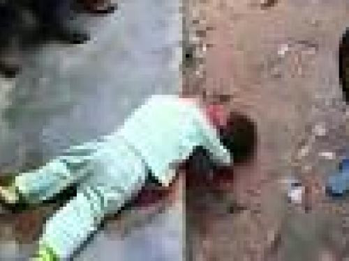 Bocah Ini Tewas Ditikam “Orang Gila” di Punggung