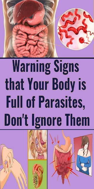 Common Symptoms You Have Parasites In Your Body (And How To Remove Them)!!