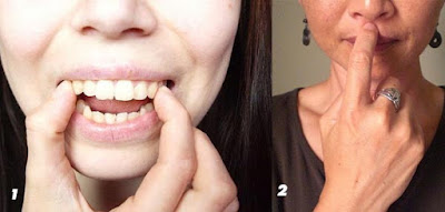 TOP những cách chữa răng vẩu hiệu quả