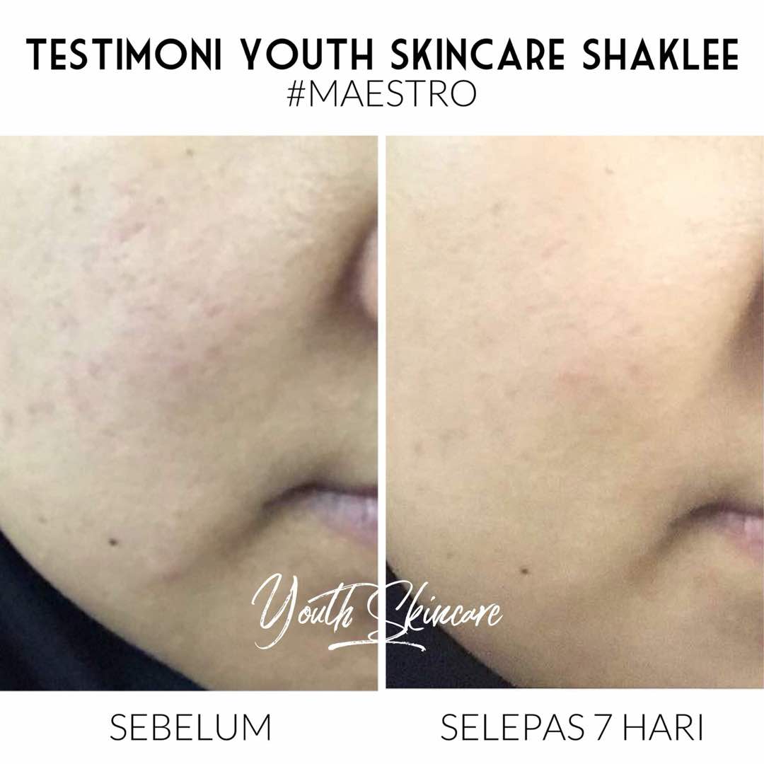 Testimoni Skincare Youth Shaklee