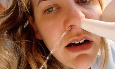 Rửa mũi đơn giản cũng có thể chữa viêm xoang