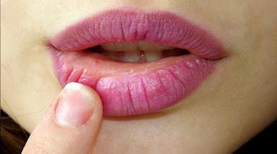 File: How To Make Lips Pink Natural Way.svg