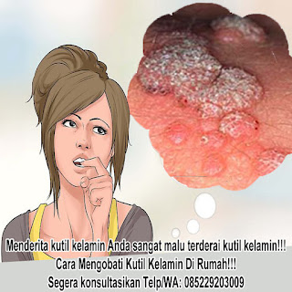 Obat Kutil kelamin