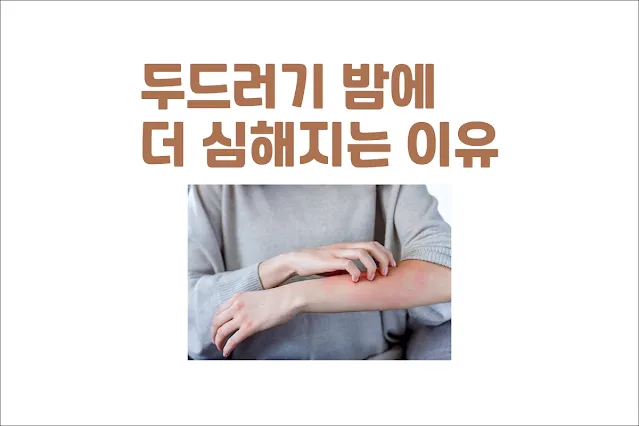 두드러기가-밤에-더-심해지는-이유