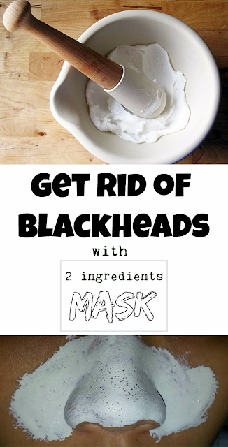 Get rid of blackheads with 2 ingredients mask!