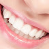 Niềng răng tốt nhất ở giai đoạn nào?