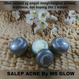 kosmetik wajah, memutihkan muka, cream wajah alami, pemutih kulit tubuh, lotion pemutih, masker untuk memutihkan wajah, produk pemutih wajah yang terdaftar di bpom, cara memutihkan muka secara alami, perawatan tubuh, masker pemutih wajah alami, tips mencerahkan wajah, perawatan wajah secara alami, cara putih alami, pemutih kulit pria, cara memutihkan badan dan wajah, cream aman untuk wajah, memutihkan wajah dengan cepat, kosmetik aman, produk perawatan wajah terbaik, pemutih muka yang bagus, pemutih wajah yang aman dan murah, krim perawatan wajah, perawatan wajah pria, bedak pemutih alami, cara memutihkan kulit wajah dengan cepat