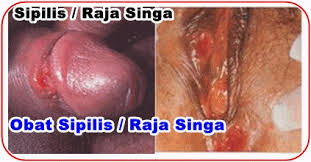Raja Singa