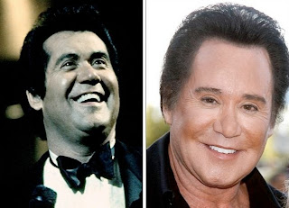 Chatter Busy: Wayne Newton Plastic Surgery