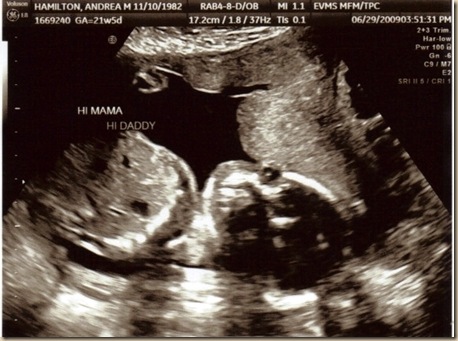 22 Week Ultrasound 3