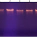 Study of the Association of PCSK9/Eam1104I Gene Polymorphism with Plasma Lipid Concentration and CAD in West Bengal Population