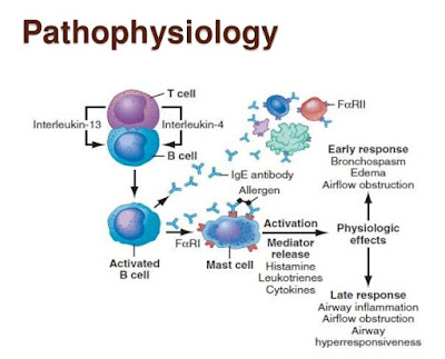 Pathophysiology of Asthma 