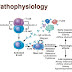 Pathophysiology of Asthma Acute, Attack and Exacerbation