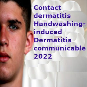 Contact dermatitis Handwashing-induced Dermatitis communicable 2022