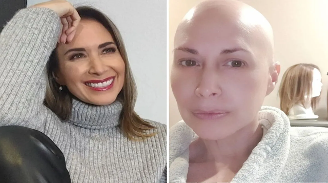 Artista de Televisa, ruega por ayuda, aparece sin cabello en medio de su lucha contra el cáncer