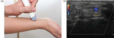 Ultrasound Artifacts