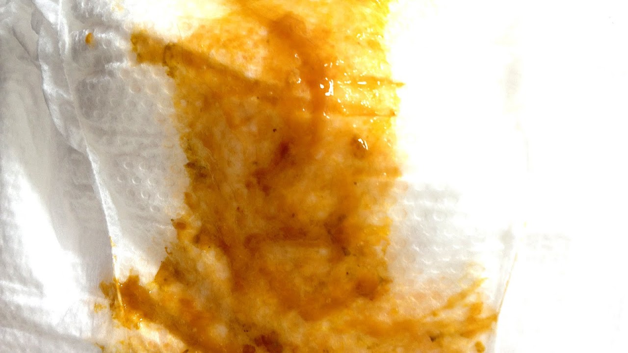 Yellow Green Liquid Diarrhea
