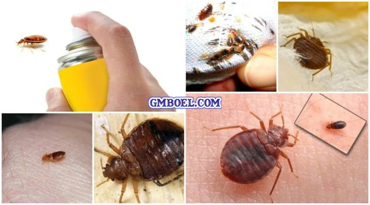 how to get bed bugs off your body