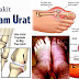 Kenali Penyakit Gout / Asam Urat Yang Menyerang Anda !