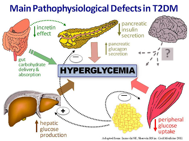Causes and Effects of Diabetes