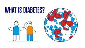 Diabetes: Definition, Causes and Symptoms Everything you need to know