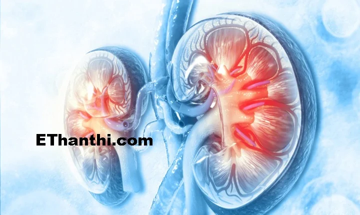 கிட்னியைக் கவனியுங்கள் மருத்துவக் குறிப்புகள் !