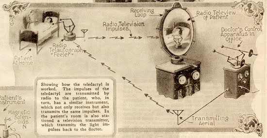 Esquema de funcionamiento teledáctilo