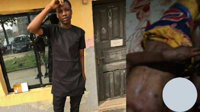 Man Punctures His Brother’s Jugular Over A Bottle Of Fanta In Lagos (Viewers Discretion) 