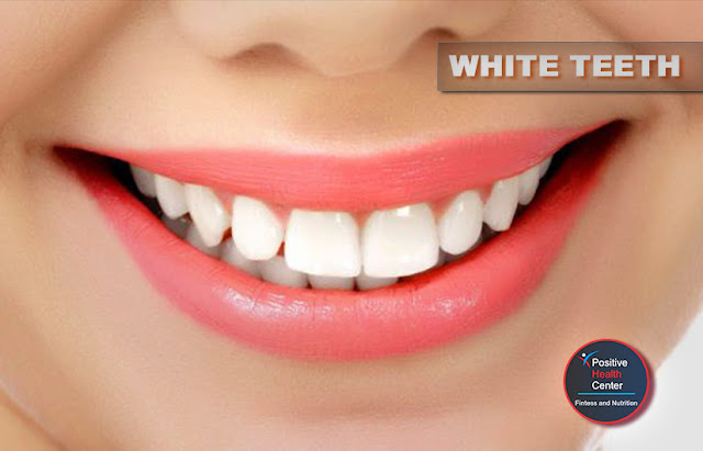 White teeth are a beauty ideal