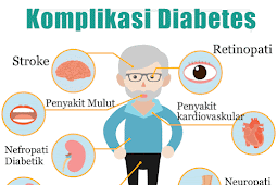 Jual Obat Herbal Diabetes Ampuh Di Paser | WA : 0822-3442-9202